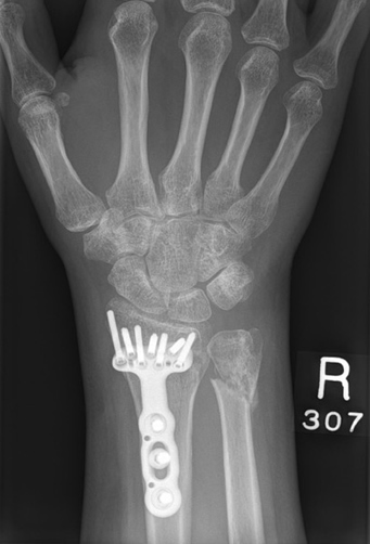 Trauma Conditions (Fractures and Tears)